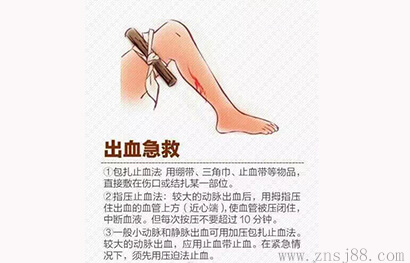 竹膠板廠告訴您出血急救方法